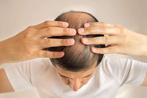 close up of man controls hair loss